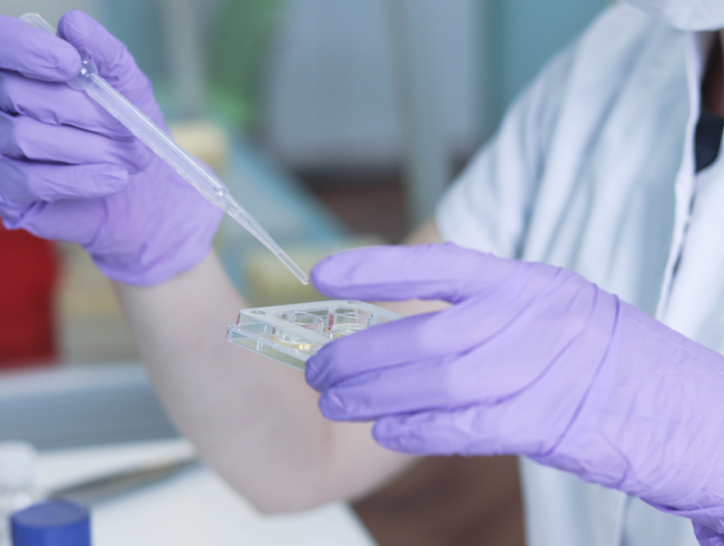 Mãos de uma pessoa com luvas roxas. Em uma de suas mãos está um recipiente a na outra uma pipeta de pasteur, utilizada para manipular soluções em volume pequeno.
