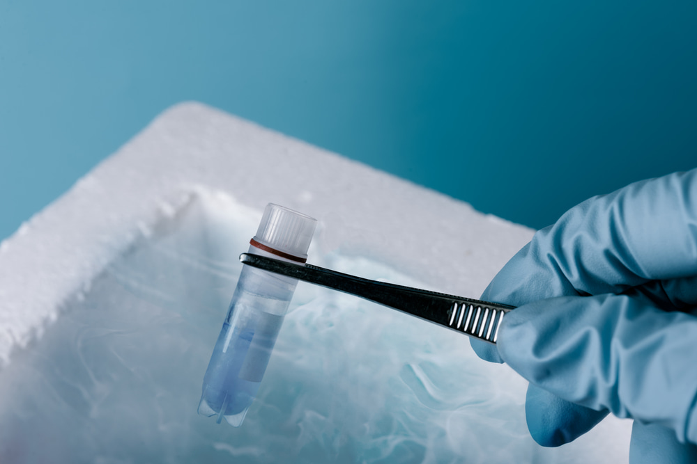 Criopreservação de amostra em laboratório. Cientista segura tubo de ensaio. Um banco de nitrogênio líquido contendo amostras criogênicas de esperma e óvulos. Criopreservação.