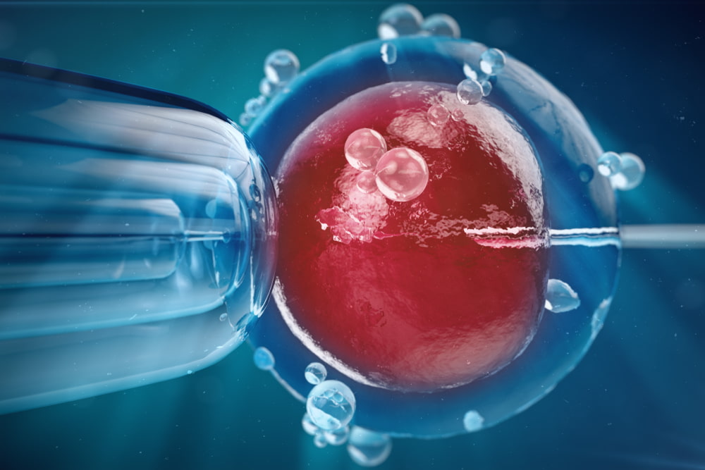 Imagem ilustrativa do tratamento de inseminação artificial. Sêmen está sendo inserido no óvulo.