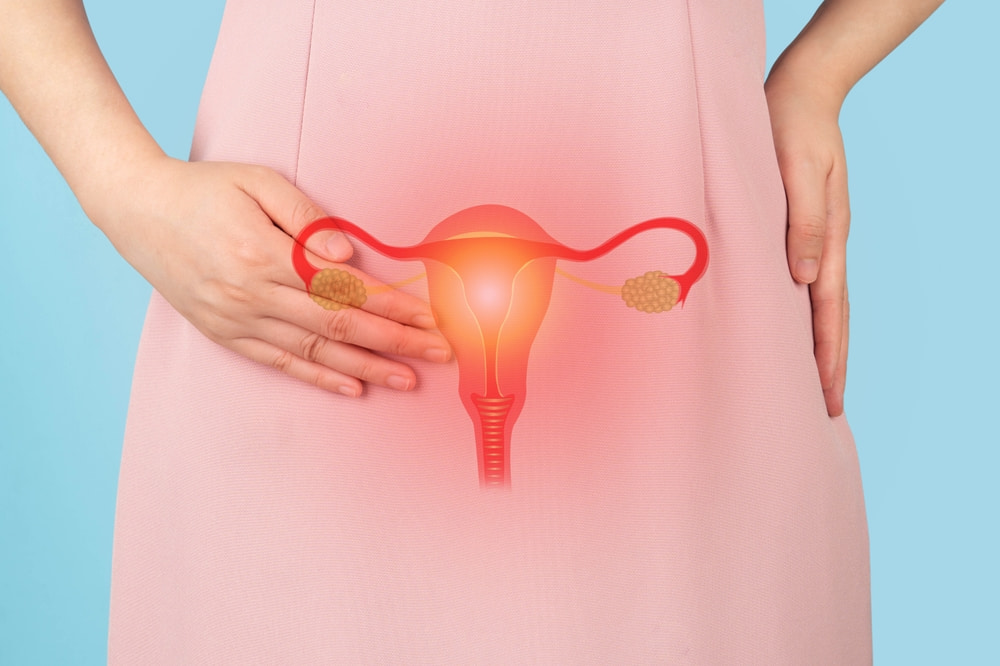 Mulher com a mão direita posicionada na região pélvica. Há uma ilustração do órgão reprodutor feminino na cor vermelha, indicando algum tipo de complicação.