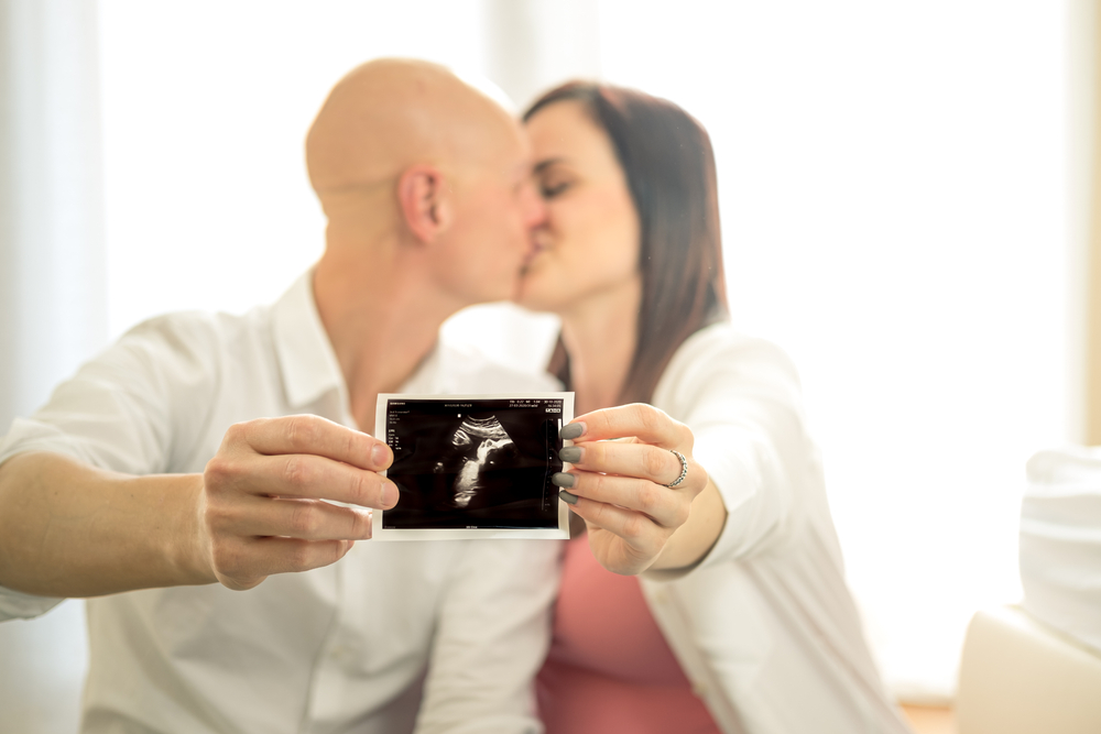 Imagem ilustrativa de casal dando um beijo e segurando a imagem de um ultrassom