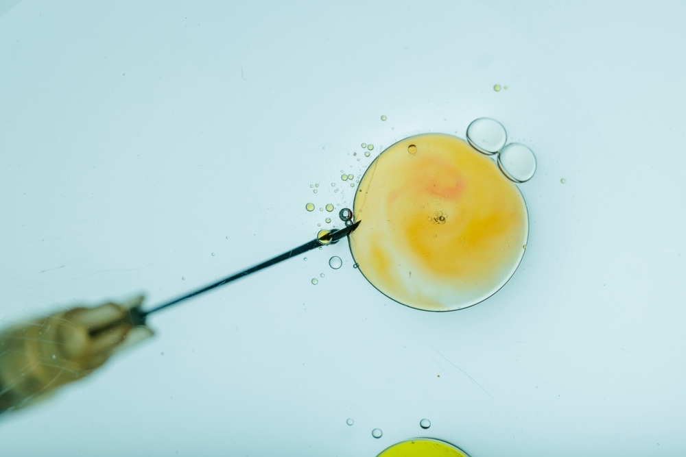 Close do procedimento de fertilização in vitro com injeção de agulha no óvulo sob microscópio, destacando o processo de fertilização in vitro.